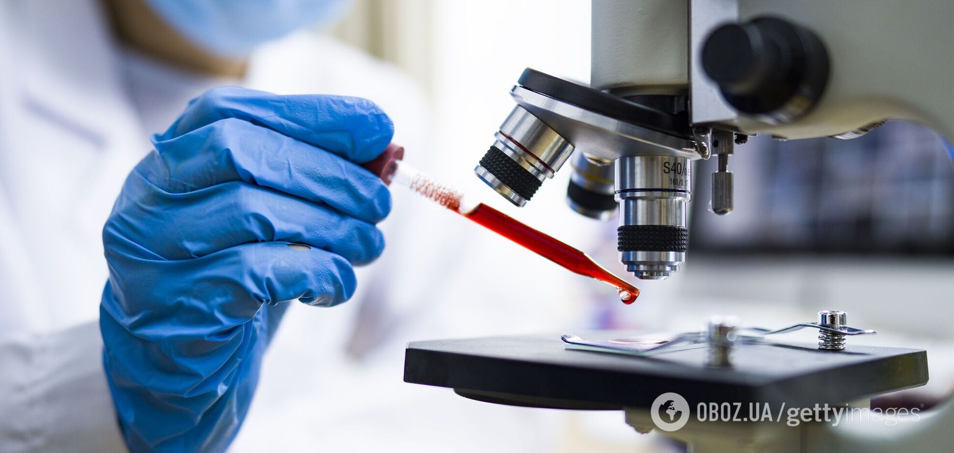 У тілі людини знайшли тканину, стійку до коронавірусу