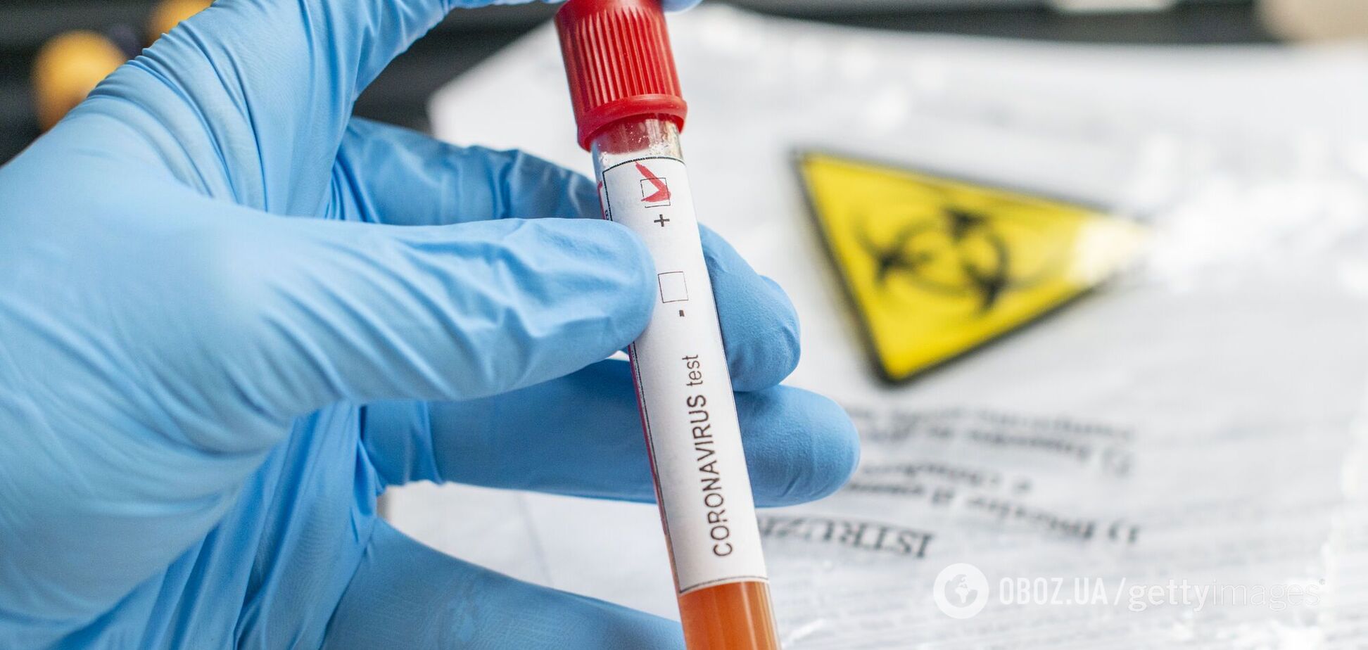 Лікар дав пораду, які аналізи потрібно здати після COVID-19