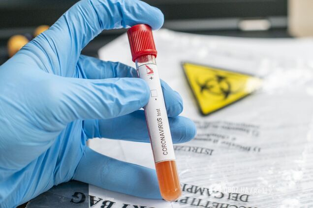Тест на коронавирус