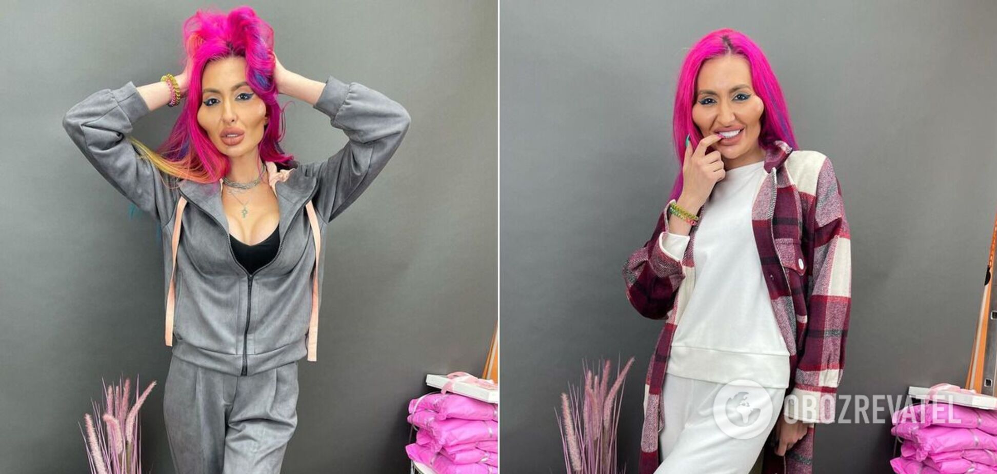 Блогерша из Украины стала обладательницей самых больших скул в мире. Фото и видео