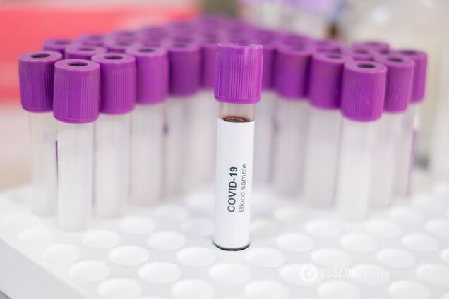 Тест на коронавирус