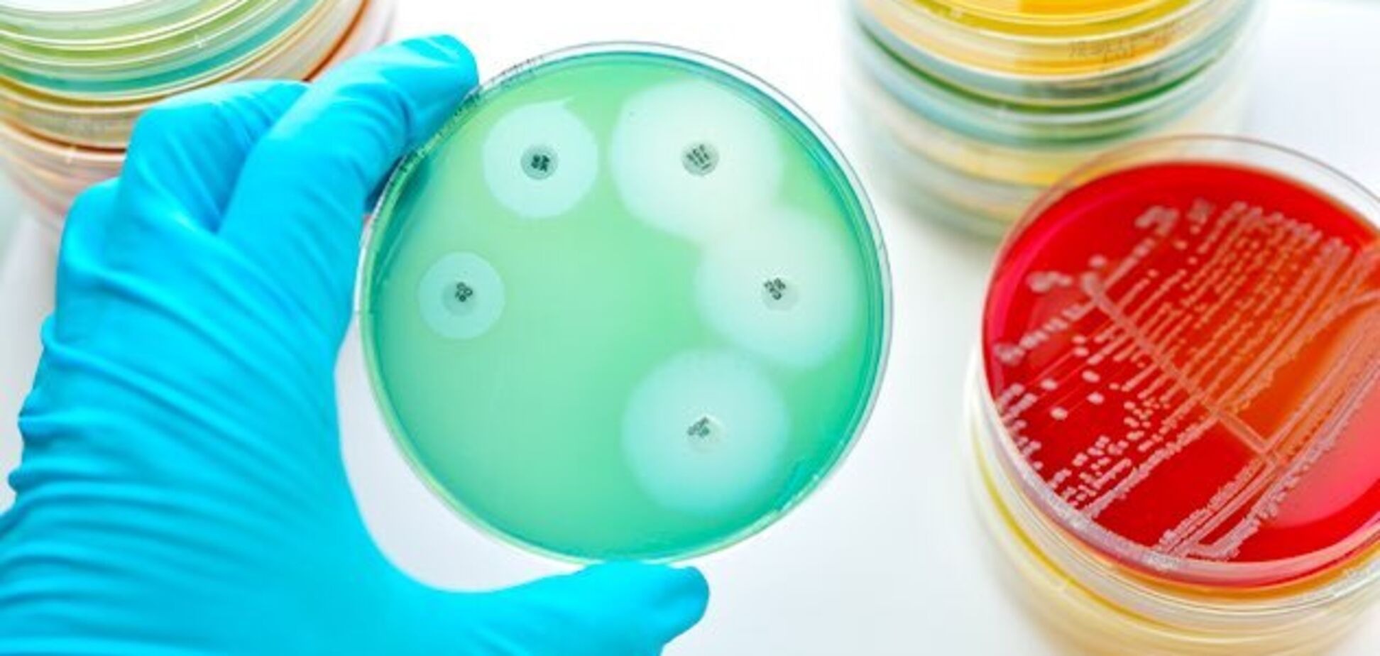 Вчені знайшли нові ефективні антибіотики проти стійких бактерій