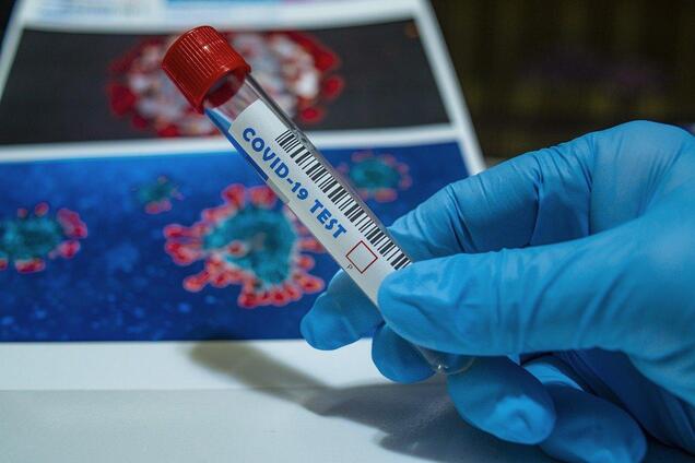 Тестування на коронавірус