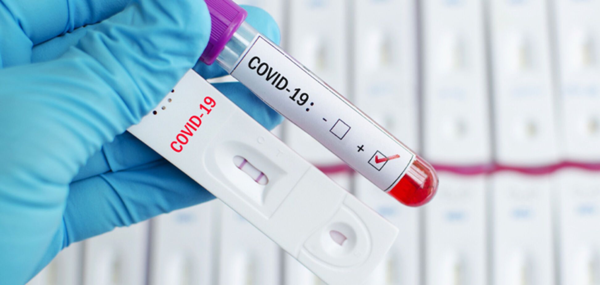 Новый тест на антитела к COVID-19 дает больше информации про иммунный ответ