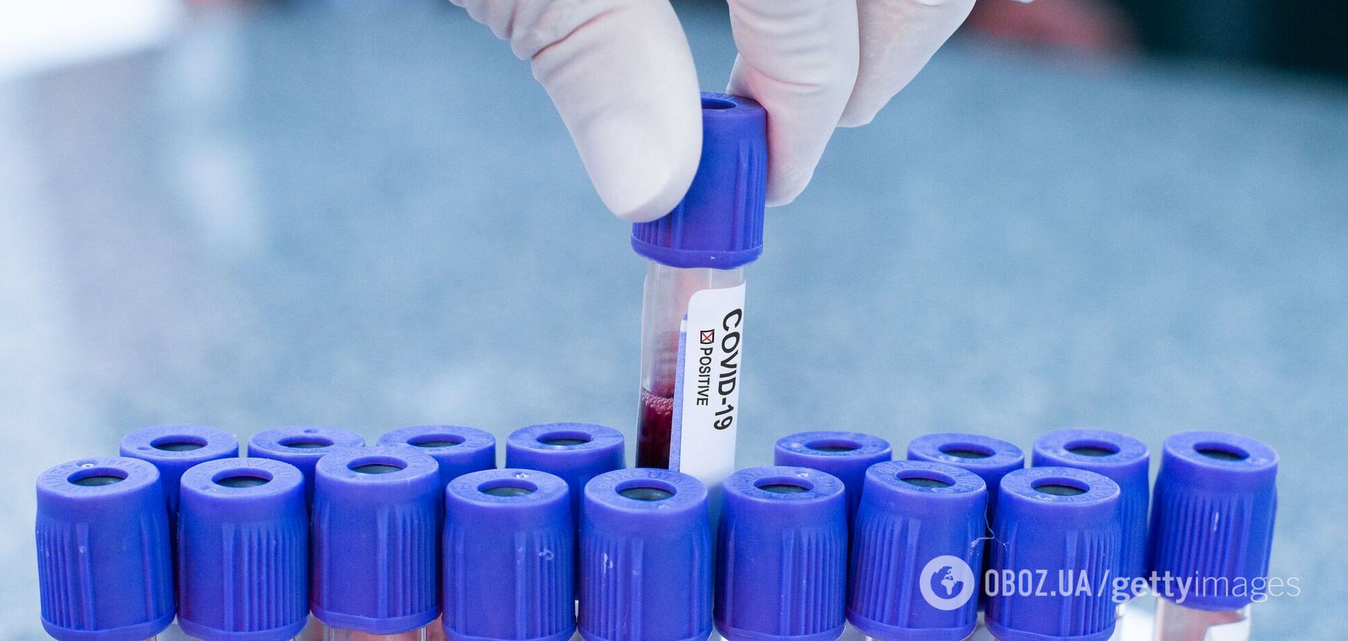 Тест на коронавирус