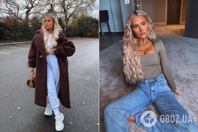 Модель решила избавиться от последствий пластики и филлеров: сколько стоит вернуть естественную внешность