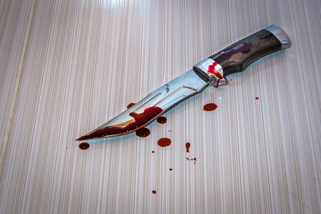 В Одессе ссора в магазине переросла в кровавую поножовщину. Фото 18+