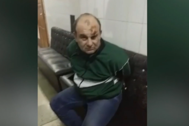 'З головою у мене вже не те': на Львівщині п'яний ексАТОвець побив фельдшерку