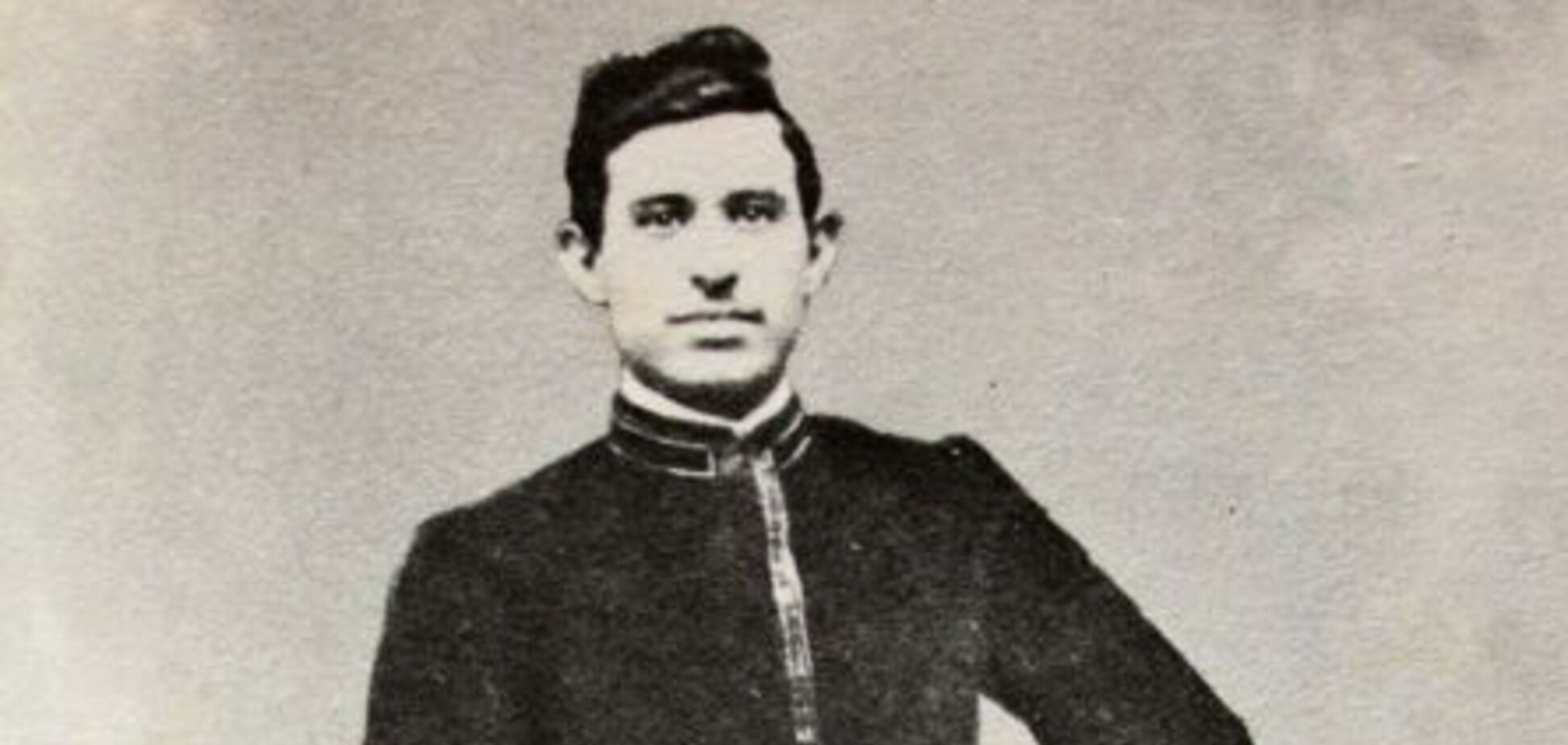 Два пениса и три ноги: кто такой Франческо Лентини и как он стал 'королем'. Фото