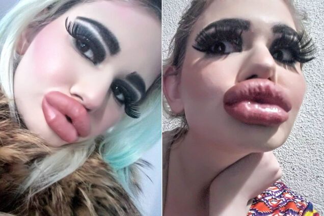Огромные ресницы и 'утиные селфи': как выглядит девушка с самыми большими губами в мире. Фото