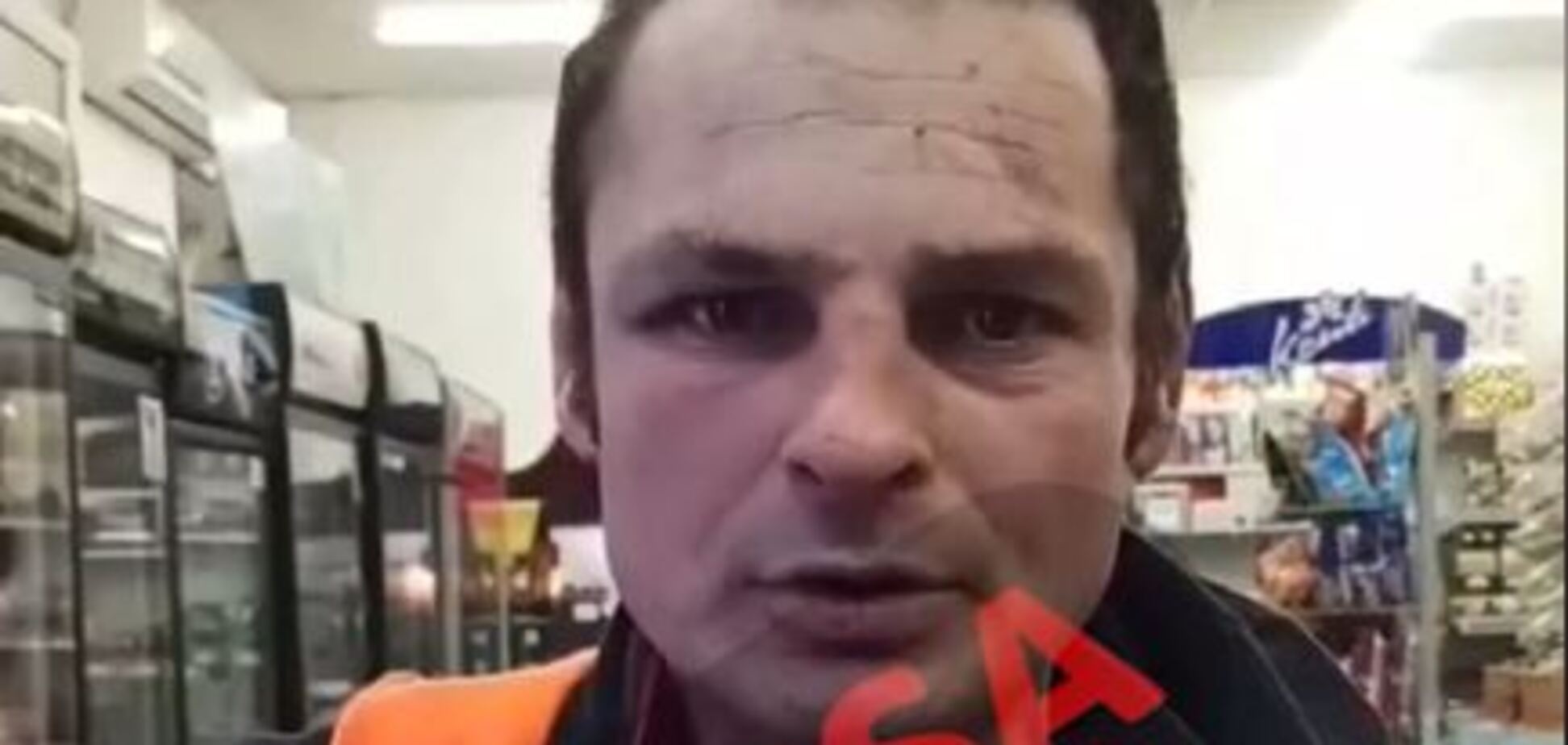 Пострадавший в поножовщине на Канатной одессит не будет мстить обидчику