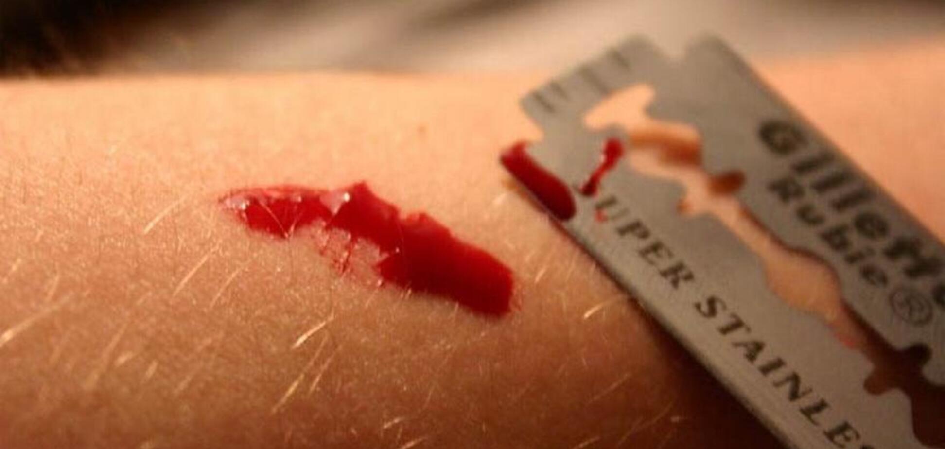 У Кривому Розі підліток перерізав собі вени: названа 'романтична' причина