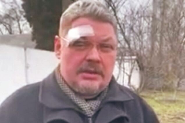 'Ударил головой в лицо': сторонники Московского патриархата напали на священника ПЦУ на Черниговщине. Фото и видео