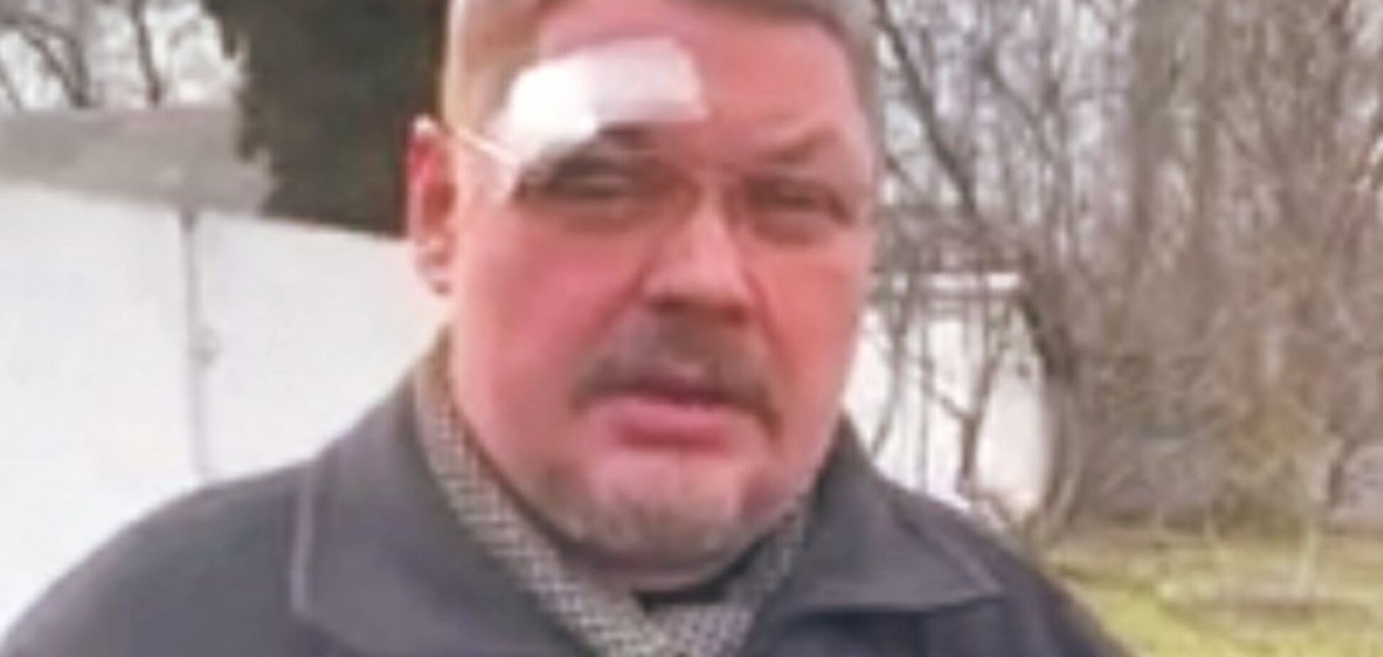 'Ударил головой в лицо': сторонники Московского патриархата напали на священника ПЦУ на Черниговщине. Фото и видео
