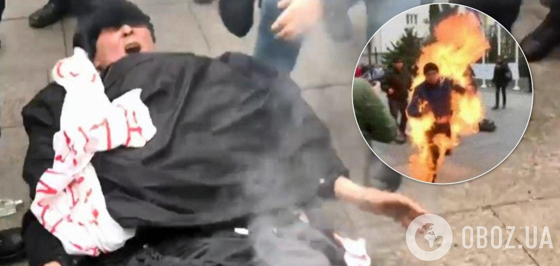 У Києві під Офісом президента чоловік скоїв самопідпал