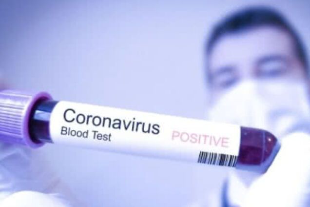 МОЗ спростувало коронавірус в українки в Італії: що відомо