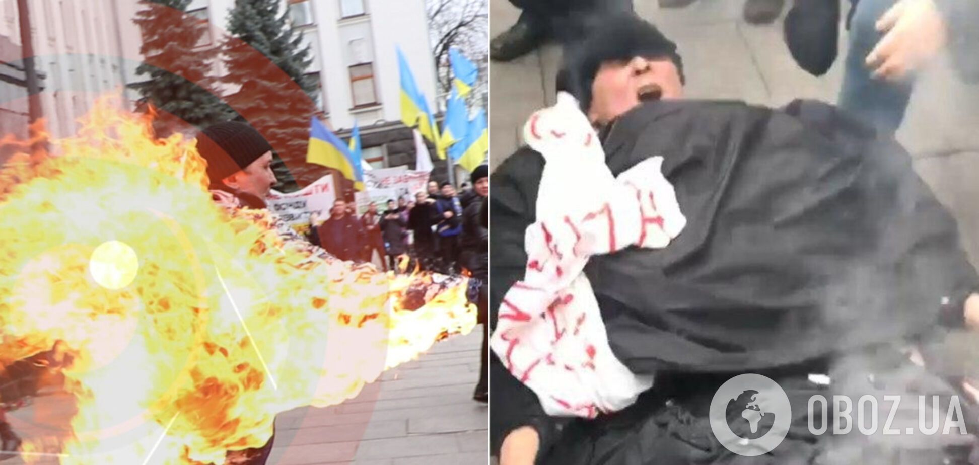 У Києві під ОПУ чоловік підпалив себе. Стало відомо про його стан