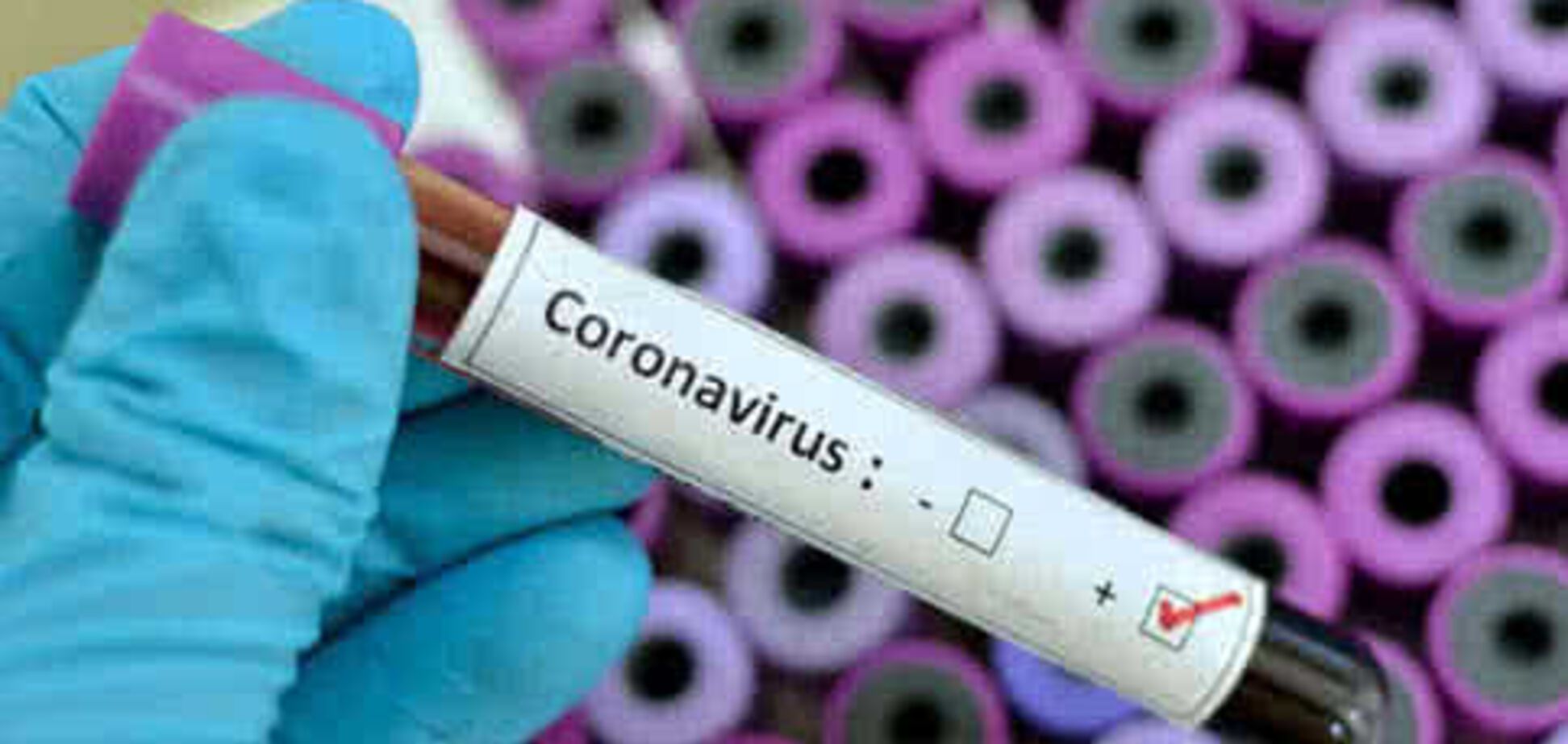 У Молдові перше зараження коронавірусів