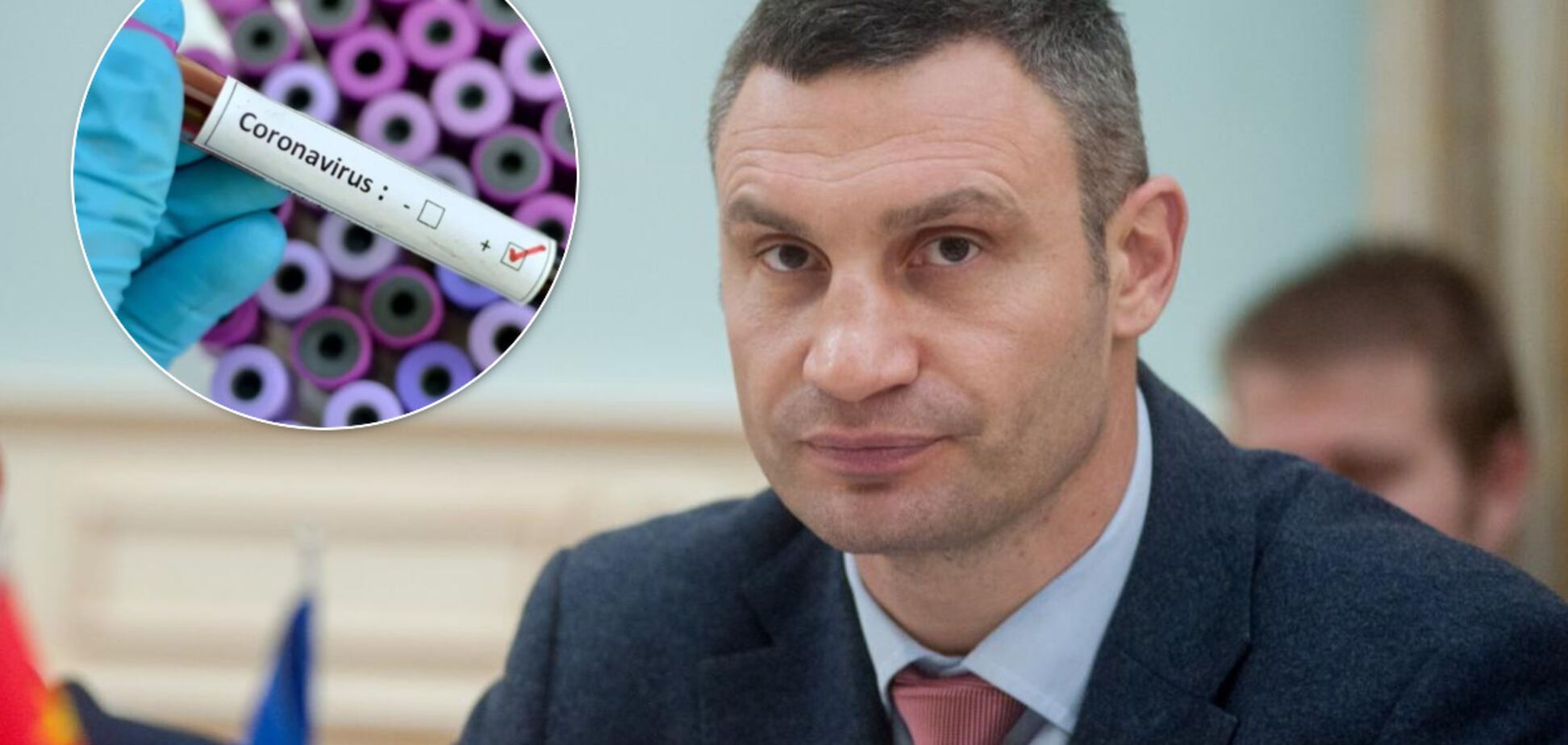 Киевская власть закупила экспресс-тесты на коронавирус