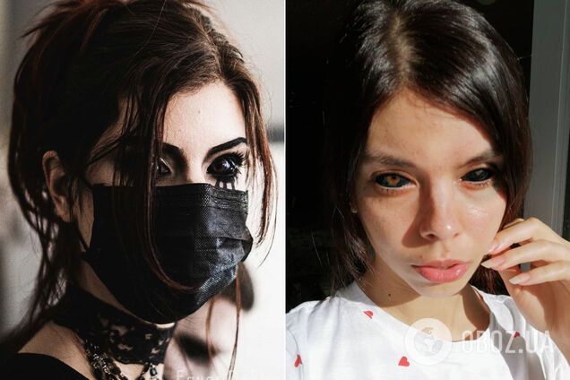 Польская модель сделала татуировки на глазах и ослепла. Фото