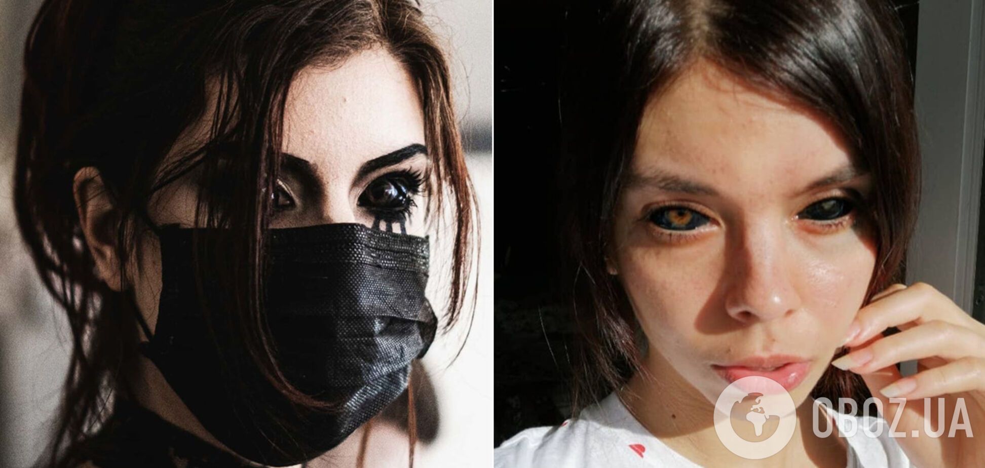 Польська модель зробила татуювання на очах і осліпла. Фото