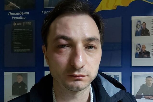 Соколова заступилася за побитого головного лікаря Інституту раку