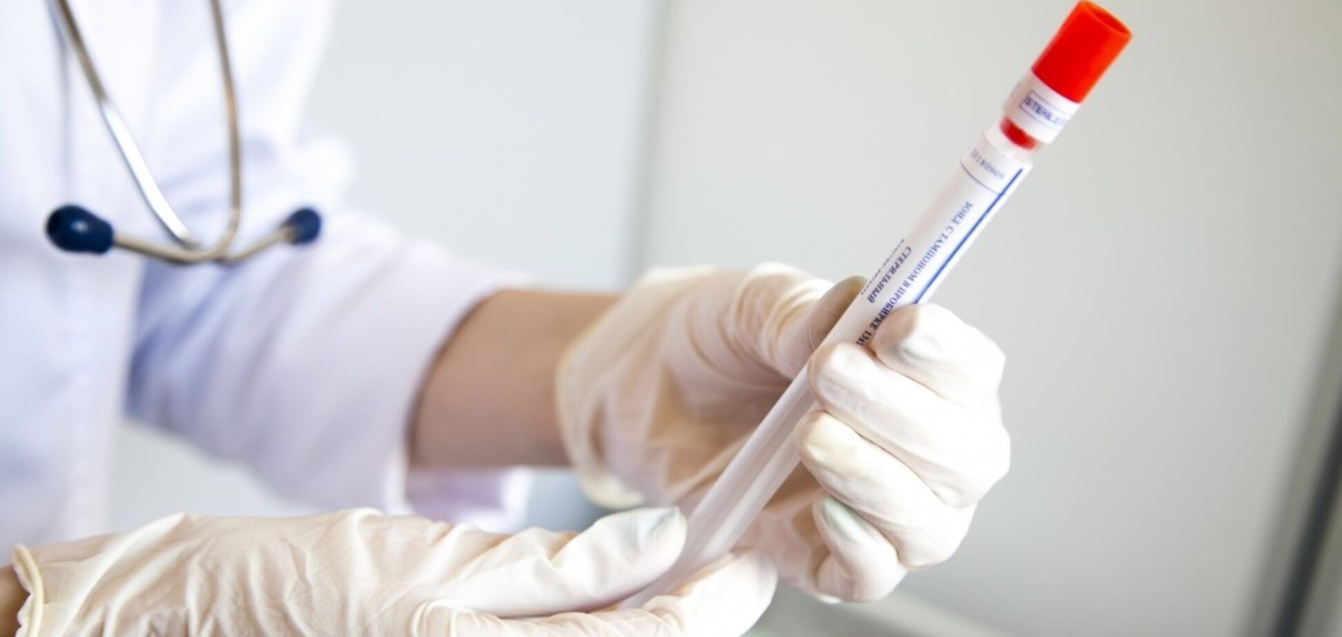 Коронавирус на Житомирщине: среди изолированных – киевляне