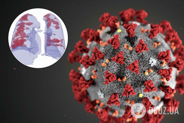 Коронавирус можно будет выявлять за 30 секунд: в Израиле взялись за разработку