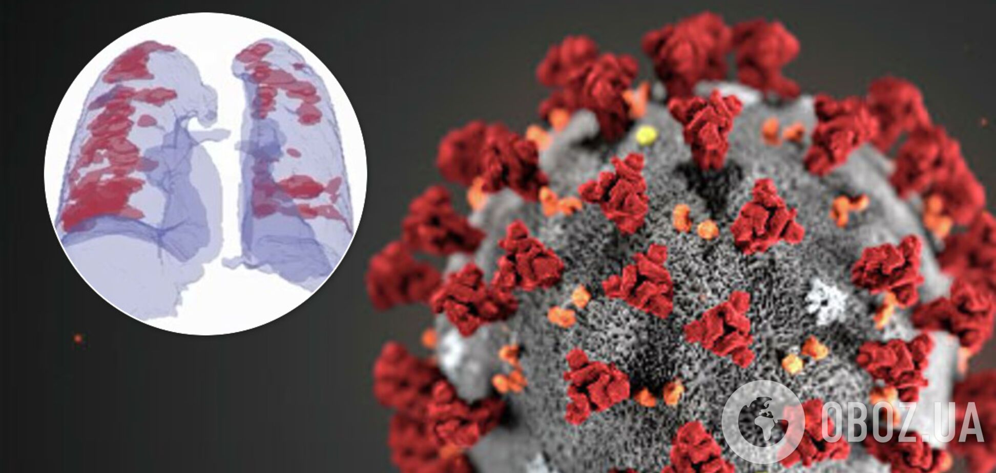 Коронавирус можно будет выявлять за 30 секунд: в Израиле взялись за разработку