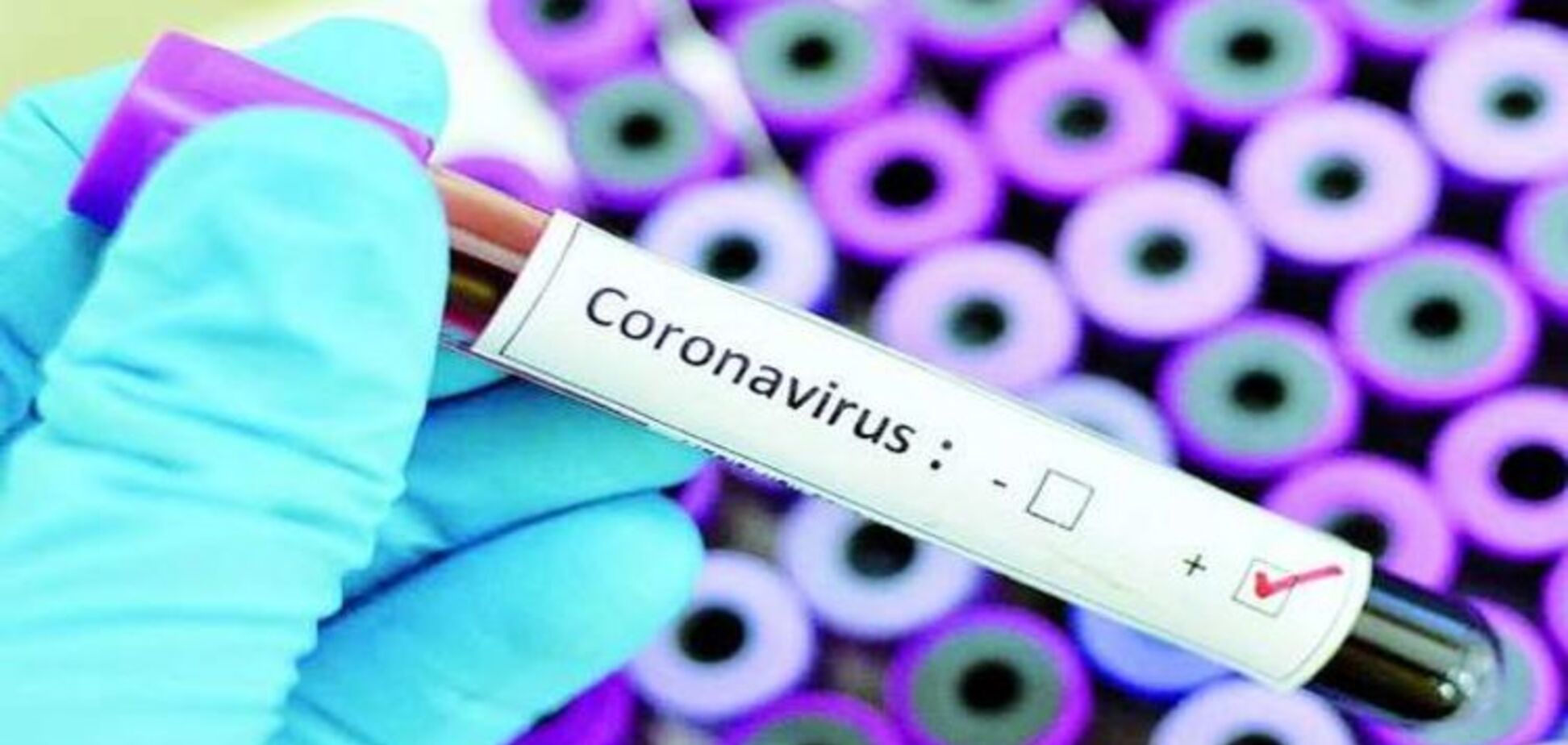 Коронавірусом захворіли тисячі людей за добу: опубліковані свіжі дані