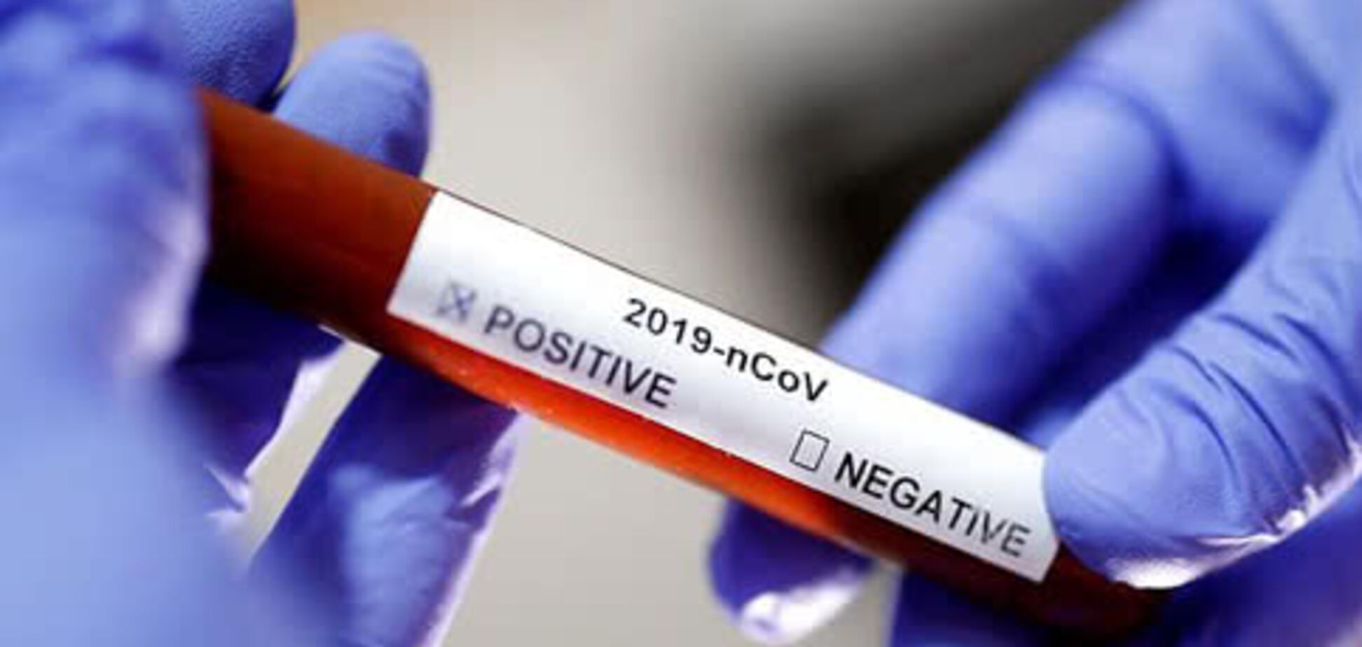 Миллиардер из Китая подарил Украине тесты на коронавирус для миллиона человек