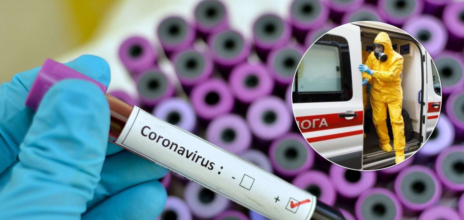 В Україні підтвердили ще два випадки зараження коронавірусом: всього хворі 5 осіб
