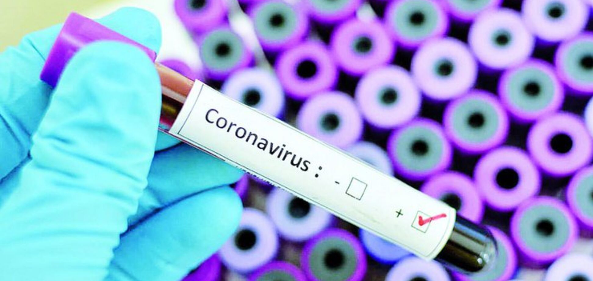 На коронавірус хворі 8 українців: МЗС озвучило свіжі дані