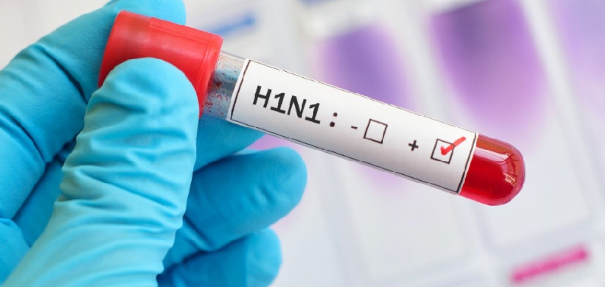 В 'ДНР' нашли более опасную инфекцию, чем коронавирус: что известно