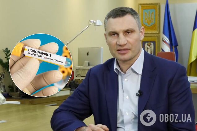 В Киеве тест на коронавирус будут делать только при наличии симптомов