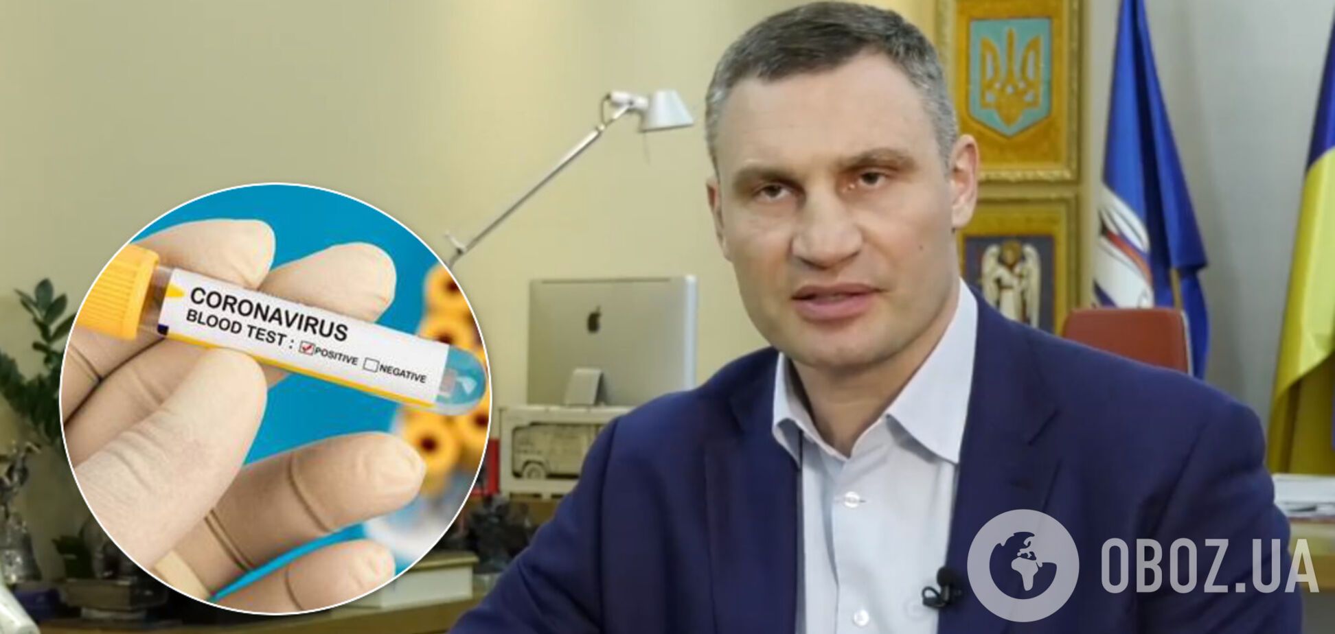 В Киеве тест на коронавирус будут делать только при наличии симптомов