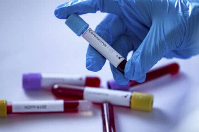 У Вінницькій області запідозрили COVID-19