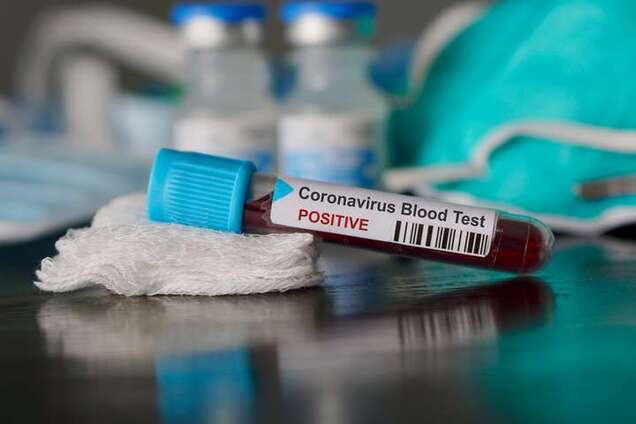 У Таїланді придумали тест, що визначає коронавірус за пів години