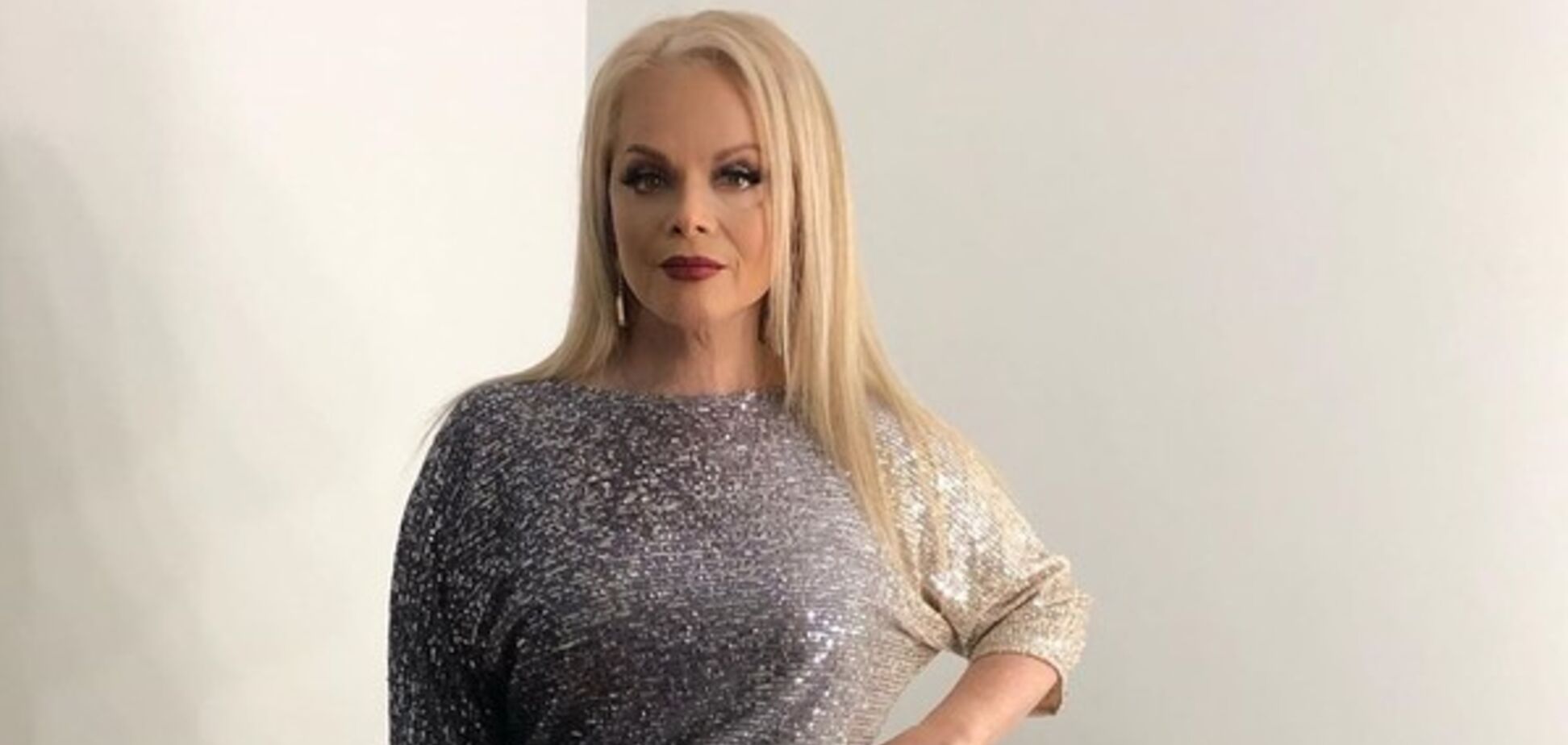 64-річна Доліна здивувала різкими змінами в зовнішності: що сталося зі співачкою