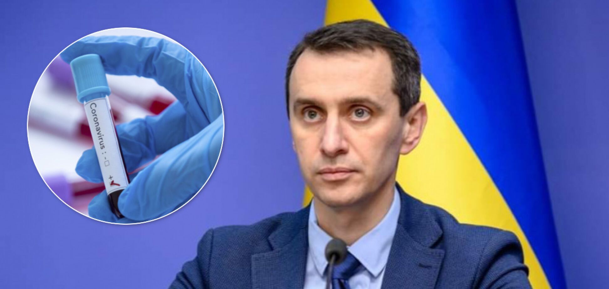 В МОЗ заявили, что охватить тестами на коронавирус всю Украину не получится