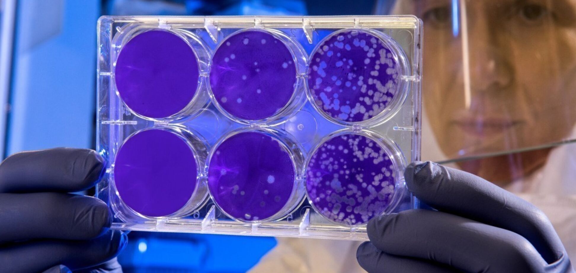 Анализ на коронавирус