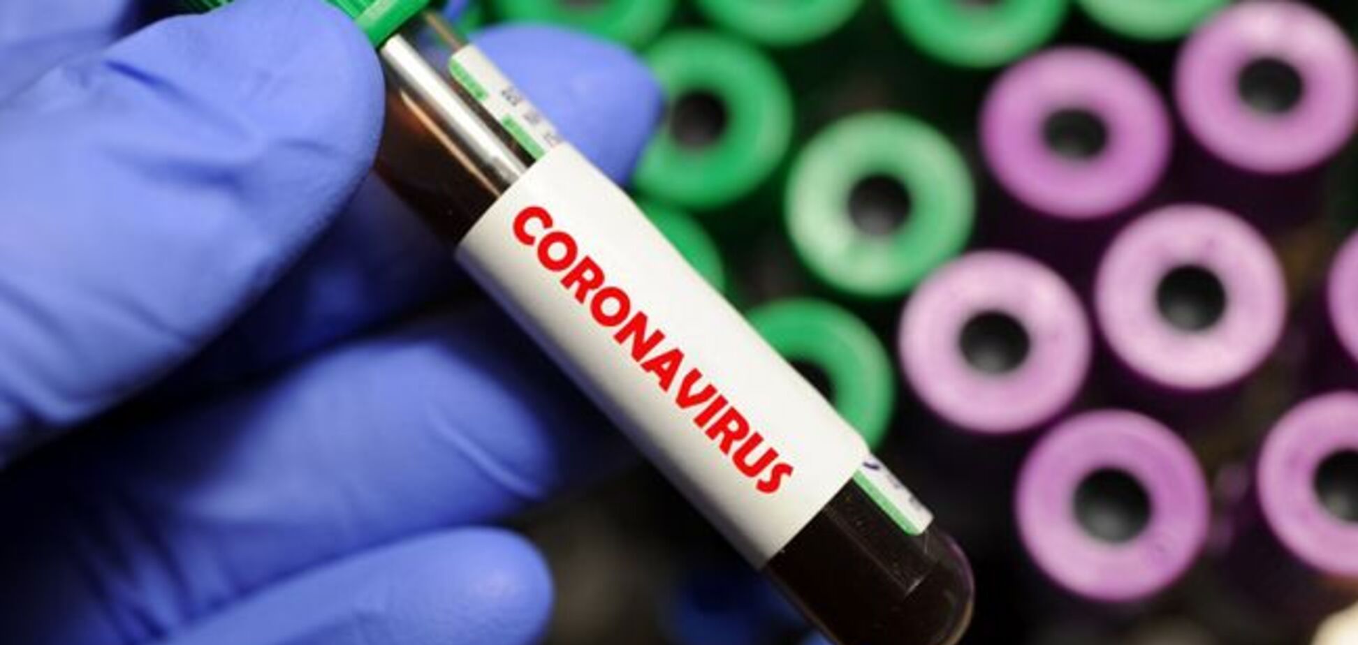 У Луцьку ЗМІ заявили про першого хворого на коронавірус: МОЗ не підтвердило