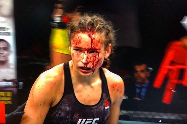 Избитая рекордсменка UFC Марина Мороз развернула в больнице флаг Украины