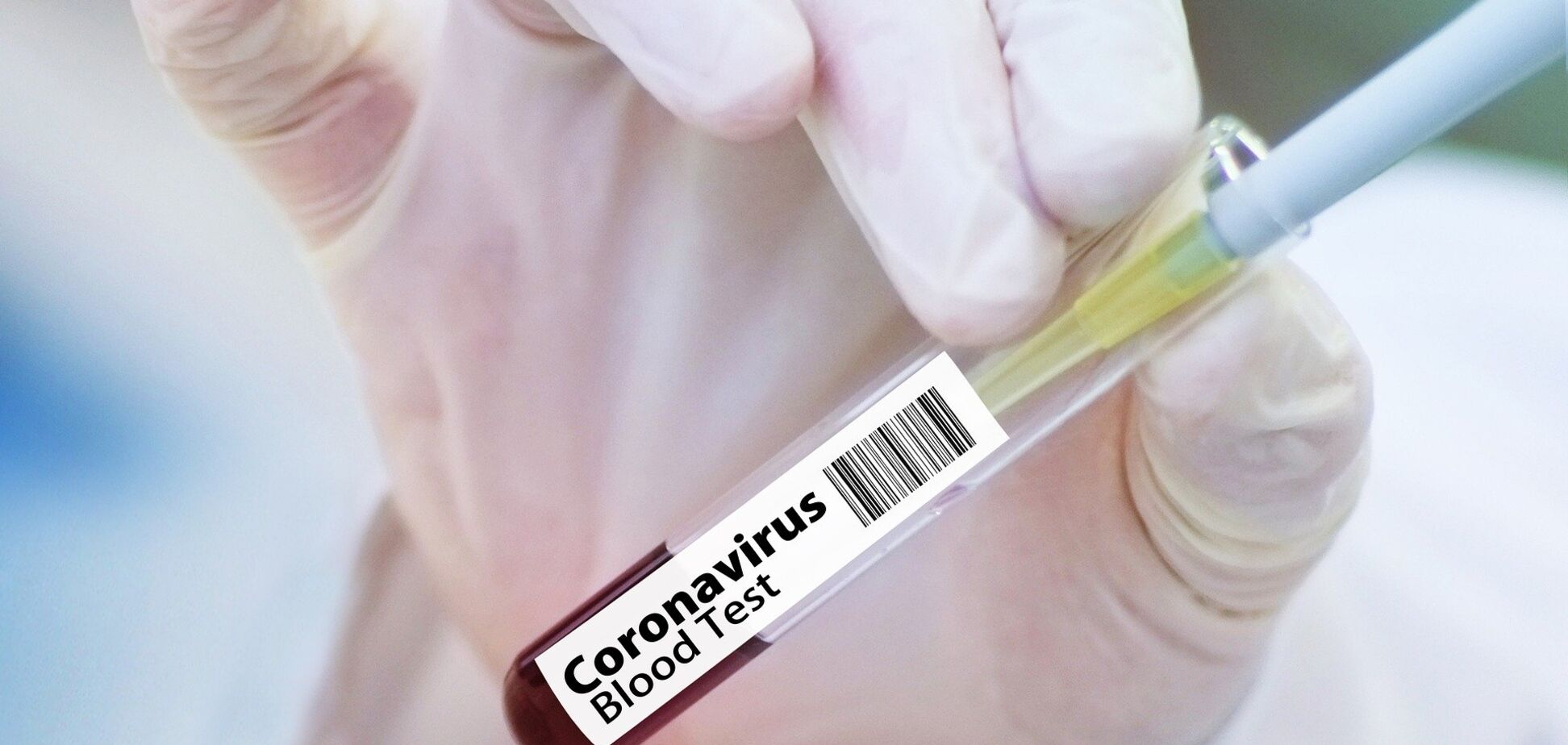У світі розробляють 20 вакцин від коронавірусу - ВООЗ