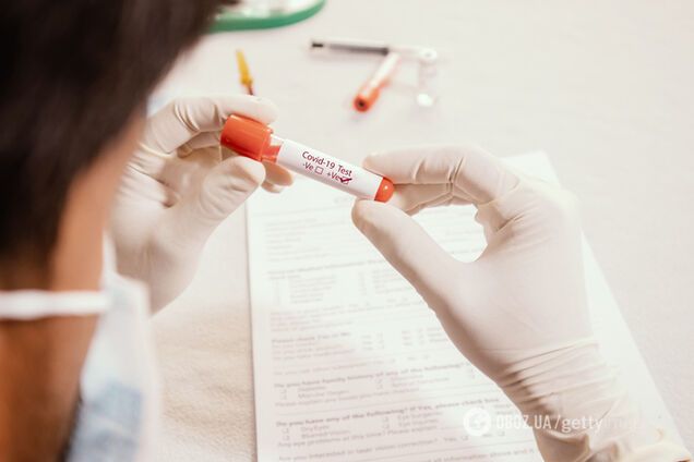 Плюс 16 за добу: кількість заражених коронавірусом в Україні зросла до 73
