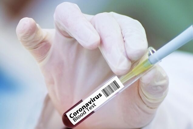 Вакцина від коронавірусу з'явиться нескоро: у ВООЗ назвали терміни