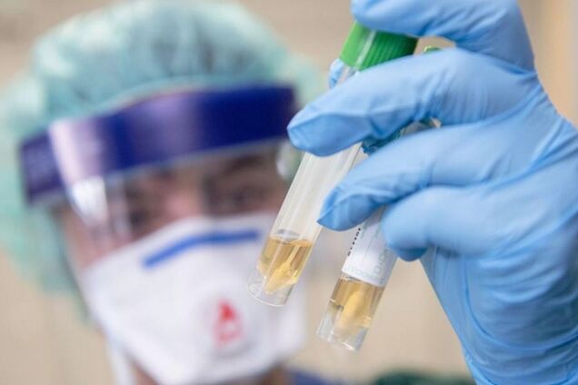 В Днепре подозревают коронавирус у 19 пациентов