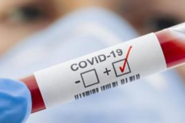 Результат за п'ять хвилин: в США запускають виробництво революційних тестів на коронавірус