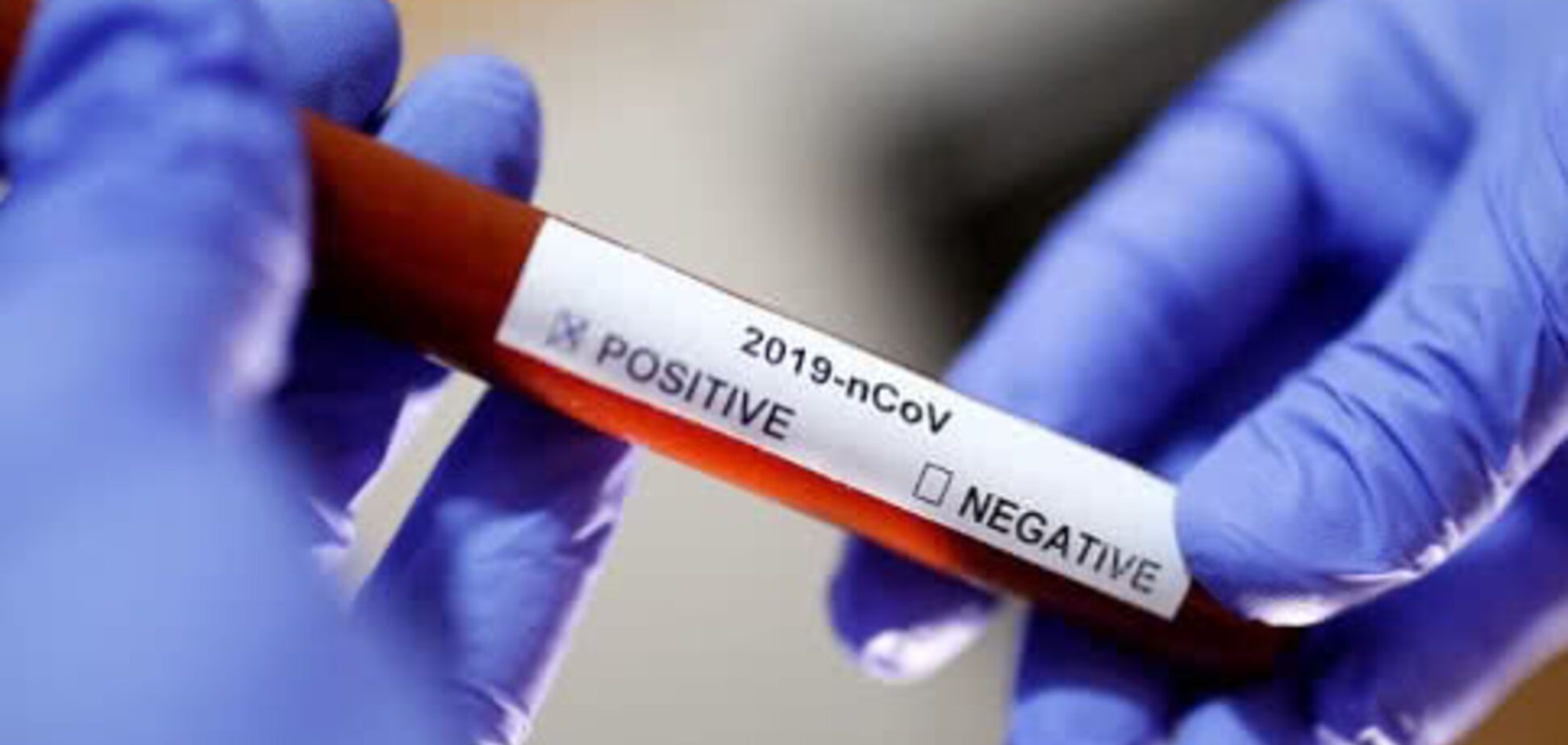 Одесские медики истратили все имеющиеся экспресс-тесты на коронавирус