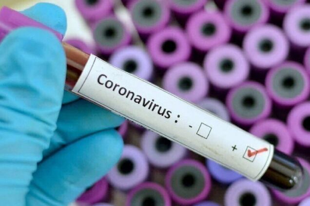 На Дніпропетровщині зафіксували ще один випадок коронавірусу